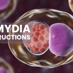 Chlamydia in teens and young adults - Care instructions