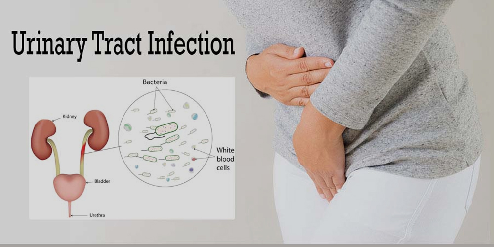 Urinary Tract Infection Treatment Online Consultation: