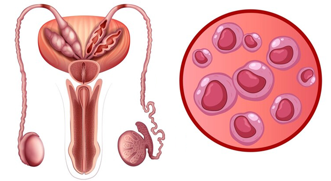 Chlamydia Testing: Types, Accuracy, and Where to Get Tested