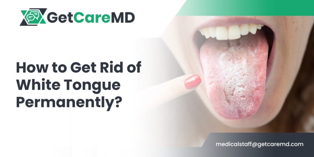 How to Get Rid of White Tongue Permanently