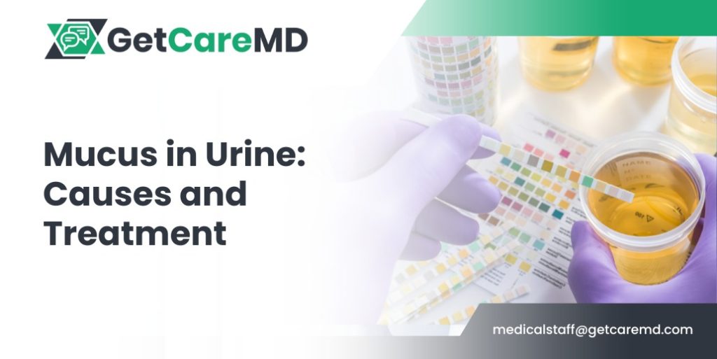 mucus-in-urine