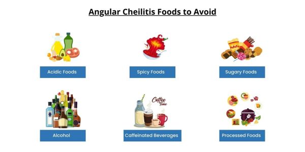 understanding-angular-cheilitis
