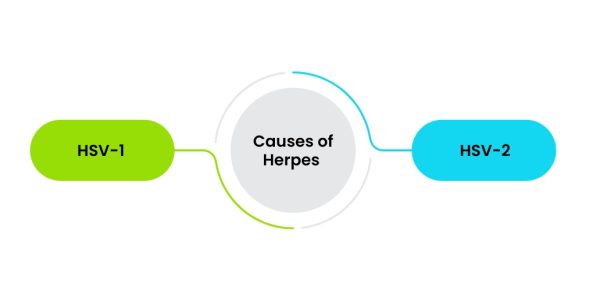 pimple-vs-herpes