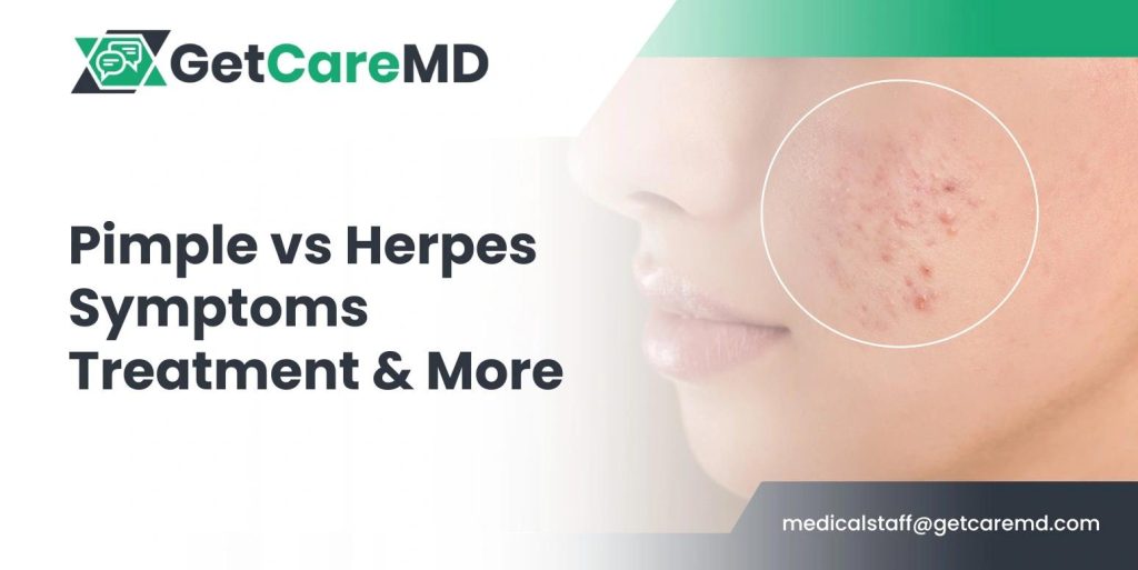 pimple-vs-herpes