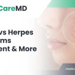 pimple-vs-herpes