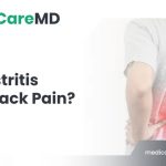 can-gastritis-cause-back-pain