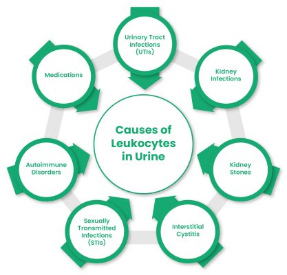 leukocytes-in-urine
