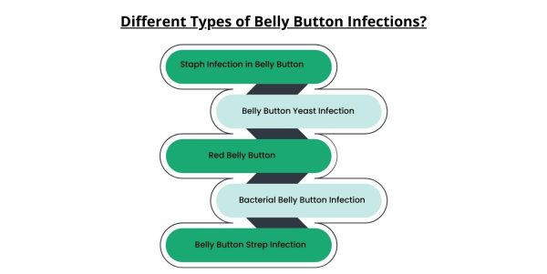 can-a-belly-button-infection-kill-you 