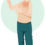 Rashes and Itching